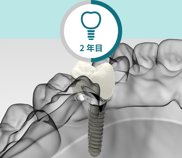 キャリアプラン