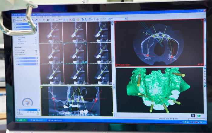 勤務医インプラント症例が多数あること